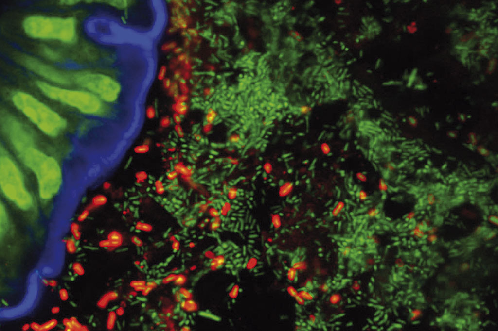 cocina-energetica-Flora-intestinal-versus-salmonella